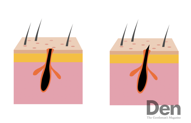 촉촉한 수염은 부드럽고 깔끔하게 절삭되는 반면, 메마른 수염은 면도 시 쉽게 끊어진다. ©Den<br>